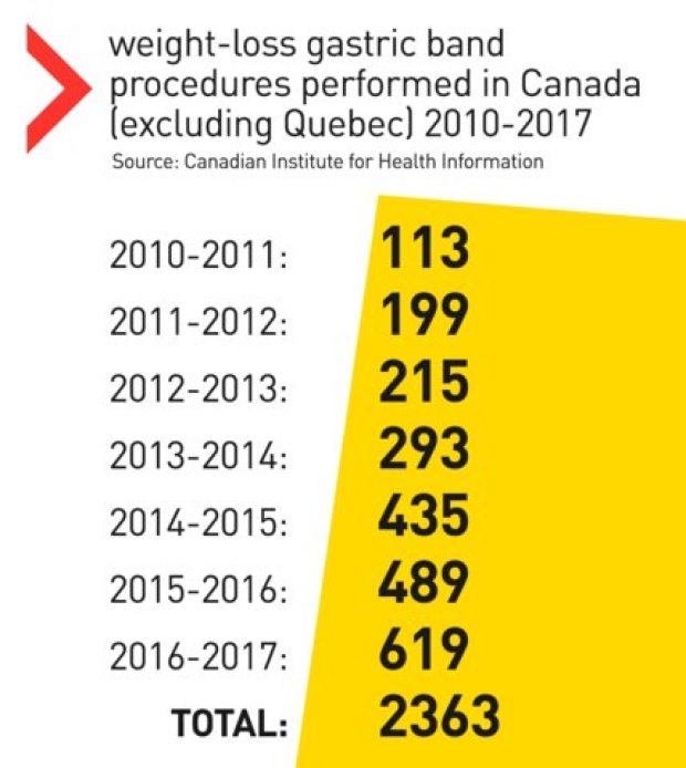 gastric-band-stats